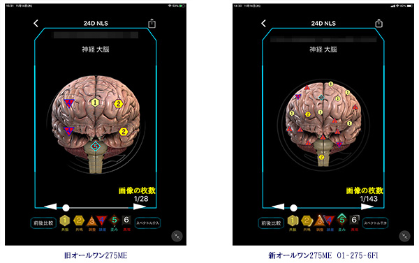 NLS24D分析